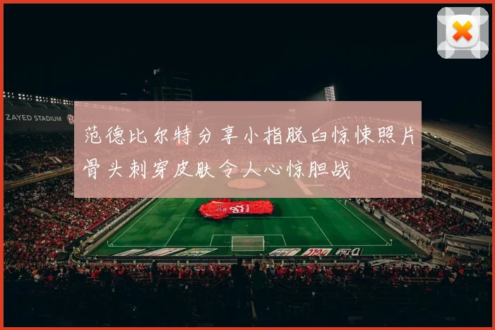范德比尔特分享小指脱臼惊悚照片骨头刺穿皮肤令人心惊胆战